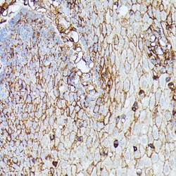 Invitrogen HLA-B Polyclonal Antibody 100 &mu;L; Unconjugated:Antibodies,