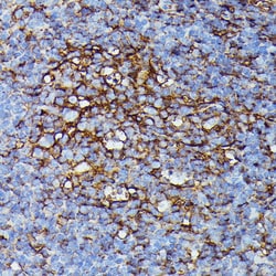 Invitrogen HLA-B Polyclonal Antibody 100 &mu;L; Unconjugated:Antibodies,