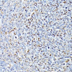 TP53I11 Polyclonal Antibody, Invitrogen&trade;