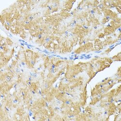 TP53I11 Polyclonal Antibody, Invitrogen&trade;