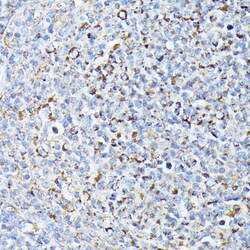 TP53I11 Polyclonal Antibody, Invitrogen&trade;
