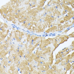 TP53I11 Polyclonal Antibody, Invitrogen&trade;
