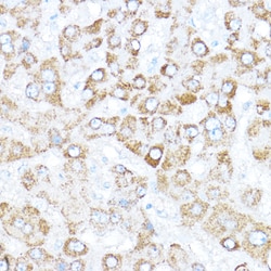 Invitrogen Kaiso Polyclonal Antibody 100 &mu;L; Unconjugated:Antikroppar