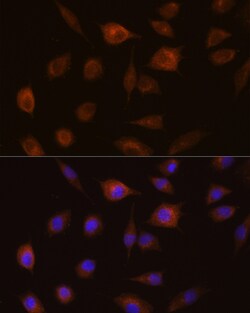 Invitrogen GSTT1 Polyclonal Antibody 100 &mu;L; Unconjugated:Antibodies,