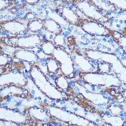 Invitrogen GSTT1 Polyclonal Antibody 100 &mu;L; Unconjugated:Antibodies,
