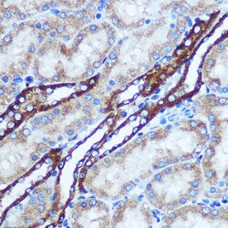 Invitrogen GSTT1 Polyclonal Antibody 100 &mu;L; Unconjugated:Antibodies,