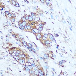 Invitrogen GSTT1 Polyclonal Antibody 100 &mu;L; Unconjugated:Antibodies,