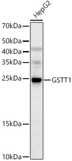 Invitrogen GSTT1 Polyclonal Antibody 100 &mu;L; Unconjugated:Antibodies,