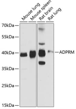 ADPRM Polyclonal Antibody, Invitrogen 100 &mu;L; Unconjugated:Antibodies,