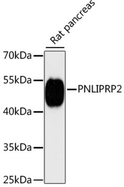 Invitrogen PNLIPRP2 Polyclonal Antibody 100 &mu;L | Buy Online | Invitrogen&trade; | Fisher Scientific