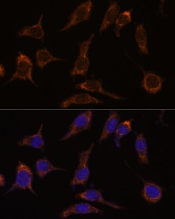 Invitrogen SCGN Polyclonal Antibody 100 &mu;L; Unconjugated:Antibodies,