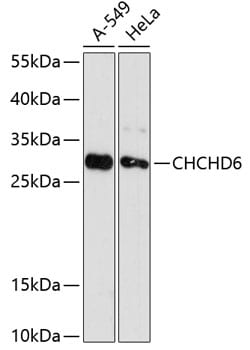 Invitrogen CHCHD6 Polyclonal Antibody 100 &mu;L; Unconjugated:Antibodies,