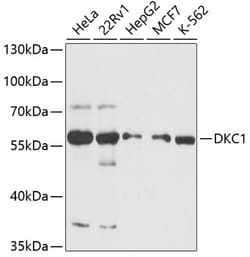 Invitrogen DKC1 Polyclonal Antibody 100 &mu;L; Unconjugated:Antibodies,