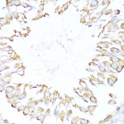 DNAJB11 Polyclonal Antibody:Antibodies, Polyclonal