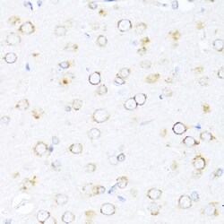 DNAJB11 Polyclonal Antibody:Antibodies, Polyclonal