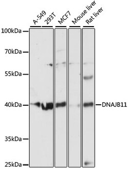 DNAJB11 Polyclonal Antibody:Antibodies, Polyclonal