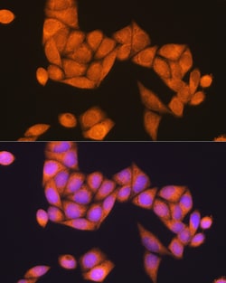 Invitrogen RAP1B Polyclonal Antibody 100 &mu;L; Unconjugated:Antibodies,