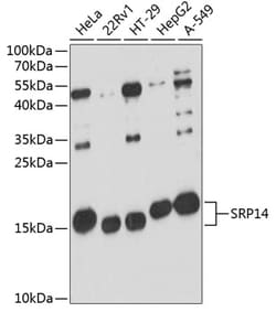 Invitrogen SRP14 Polyclonal Antibody 100 &mu;L | Buy Online | Invitrogen&trade; | Fisher Scientific