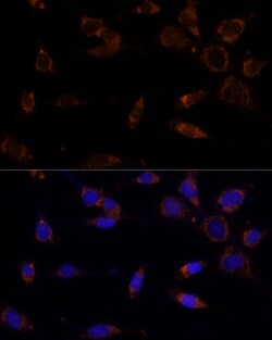 Invitrogen MTCH2 Polyclonal Antibody 100 &mu;L; Unconjugated:Antibodies,