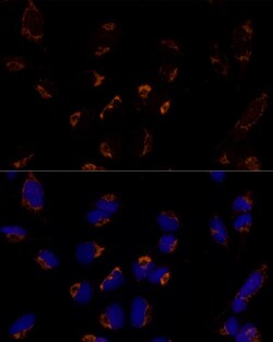 Invitrogen MTCH2 Polyclonal Antibody 100 &mu;L; Unconjugated:Antibodies,