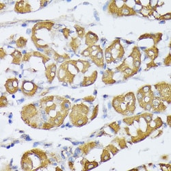 Invitrogen VAPA Polyclonal Antibody 100 &mu;L; Unconjugated:Antibodies,