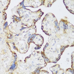 Invitrogen ECH1 Polyclonal Antibody 100 &mu;L; Unconjugated:Antibodies,
