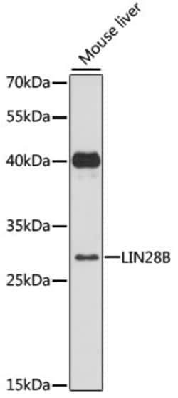 Invitrogen LIN28B Polyclonal Antibody 100 &mu;L; Unconjugated:Antibodies,