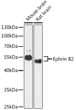 Invitrogen Ephrin B2 Polyclonal Antibody 100 &mu;L; Unconjugated:Antibodies,
