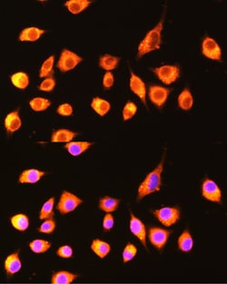 GBP2 Polyclonal Antibody, Invitrogen 100 &mu;L; Unconjugated:Antibodies,