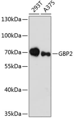 GBP2 Polyclonal Antibody, Invitrogen 100 &mu;L; Unconjugated:Antibodies,