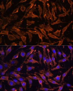 Invitrogen RANK Polyclonal Antibody 100 &mu;L; Unconjugated:Antibodies,