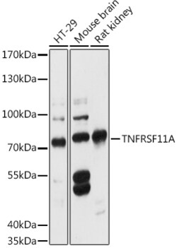 Invitrogen RANK Polyclonal Antibody 100 &mu;L; Unconjugated:Antibodies,
