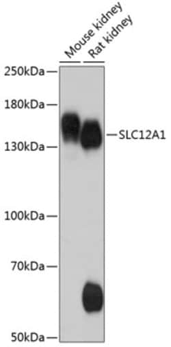 Invitrogen NKCC2 Polyclonal Antibody 100 &mu;L | Buy Online | Invitrogen&trade; | Fisher Scientific