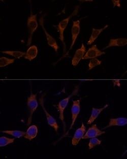 Invitrogen RPL32 Polyclonal Antibody 100 &mu;L; Unconjugated:Antibodies,