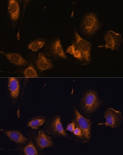 Invitrogen RPL32 Polyclonal Antibody 100 &mu;L; Unconjugated:Antibodies,