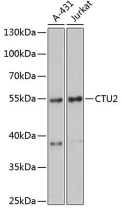 CTU2 Polyclonal Antibody, Invitrogen 100 &mu;L; Unconjugated:Antibodies,