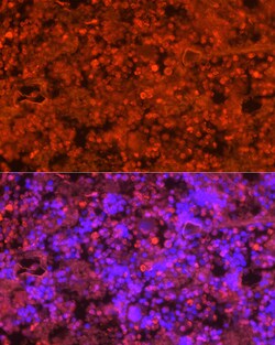 Invitrogen Neutrophil elastase Polyclonal Antibody 100 &mu;L | Buy Online | Invitrogen&trade; | Fisher Scientific