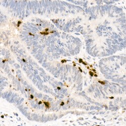 Invitrogen Neutrophil elastase Polyclonal Antibody 100 &mu;L | Buy Online | Invitrogen&trade; | Fisher Scientific