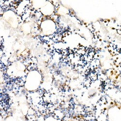Invitrogen Neutrophil elastase Polyclonal Antibody 100 &mu;L | Buy Online | Invitrogen&trade; | Fisher Scientific
