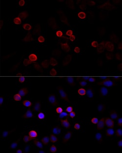 Filamin 2 Polyclonal Antibody:Antibodies, Polyclonal