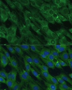 HAL Polyclonal Antibody:Antibodies, Polyclonal