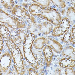 HAL Polyclonal Antibody:Antibodies, Polyclonal