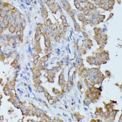 HAL Polyclonal Antibody:Antibodies, Polyclonal