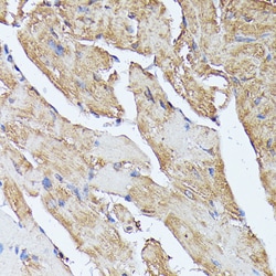 HAL Polyclonal Antibody:Antibodies, Polyclonal