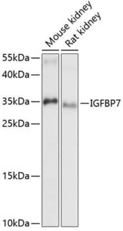 Invitrogen IGFBP7 Polyclonal Antibody 100 &mu;L; Unconjugated:Antibodies,