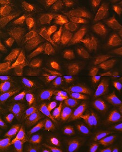 Invitrogen RAP Polyclonal Antibody 100 &mu;L; Unconjugated:Antibodies,