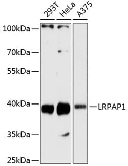 Invitrogen RAP Polyclonal Antibody 100 &mu;L; Unconjugated:Antibodies,