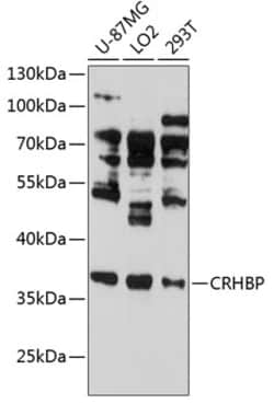 CRHBP Polyclonal Antibody 100 &mu;L | Buy Online | Thermo Scientific | Fisher Scientific
