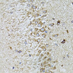 MTNR1A Polyclonal Antibody:Antibodies, Polyclonal