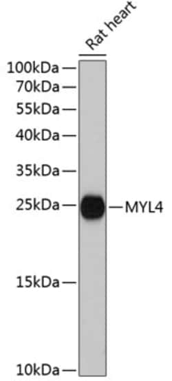 MYL4 Polyclonal Antibody 100 &mu;L | Buy Online | Invitrogen | Fisher Scientific